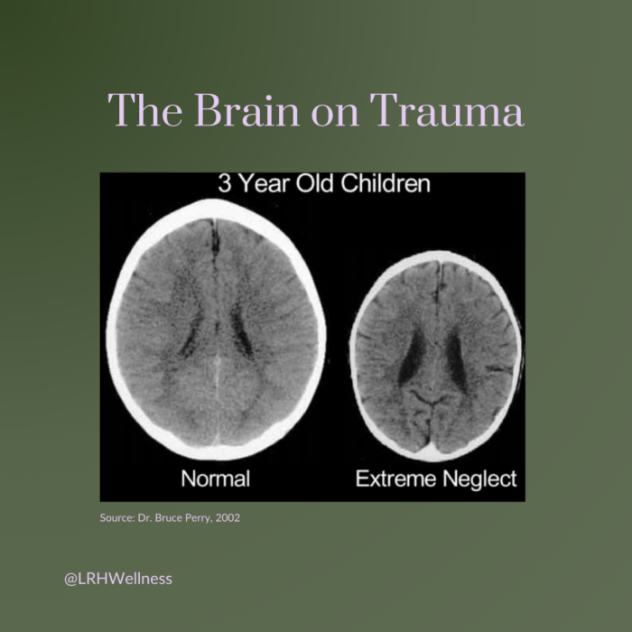 8 Ways Trauma Impacts the Brain